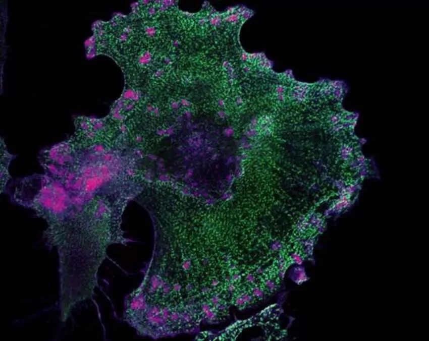 Investigadores del CSIC desarrollan un método que utiliza nanotecnología para mejorar los fármacos contra el cáncer
