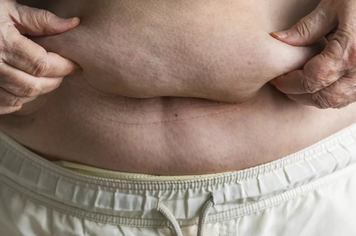 Salud recuerda que la prevención es la mejor herramienta contra la obesidad