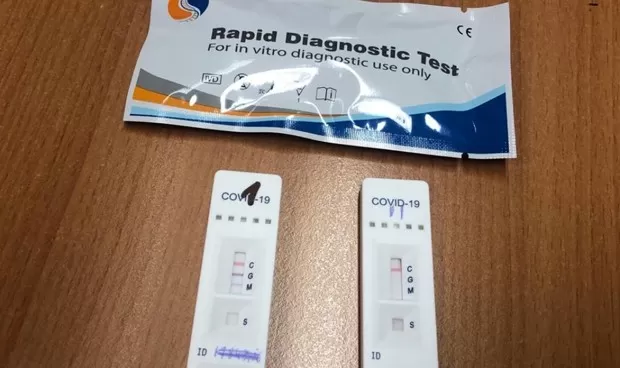 El Gobierno admite ahora que ha hecho menos test de Covid-19 de los que dice